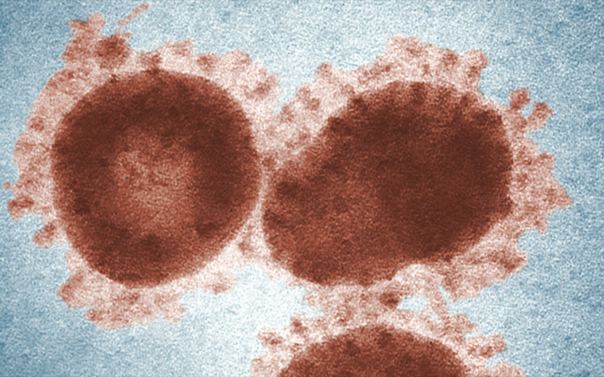 Notfallplan für den Coronavirus in Wien: Ärztekammer, Stadt Wien und KAV informieren